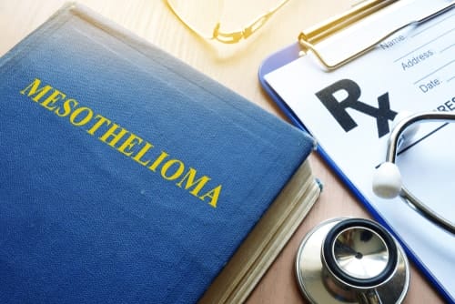 Mesothelioma Medical Guide with Stethoscope and Prescription Pad - Ferraro Law Firm Book titled “Mesothelioma” placed beside a stethoscope, prescription pad, and glasses, symbolizing medical and legal concerns of asbestos-related cancer.