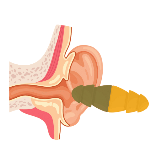 3M-Combat-Arms-Earplugs-Lawsuit-What-Veterans-Should-Know - Ferraro Law Firm 3M Combat Arms Earplugs Lawsuit: What Veterans Should Know